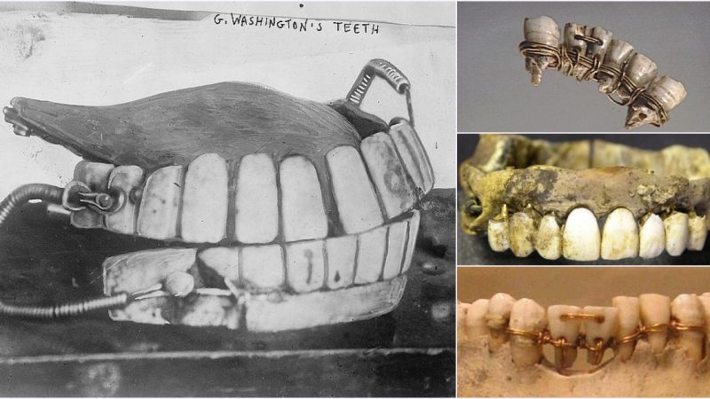 A Journey through Time: 14,000 Years of Dentistry and its Evolution