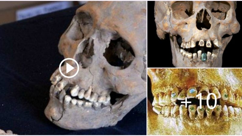 In Mexico Ruins, a 1,600-year-old elongated skull with stone-encrusted teeth was discovered