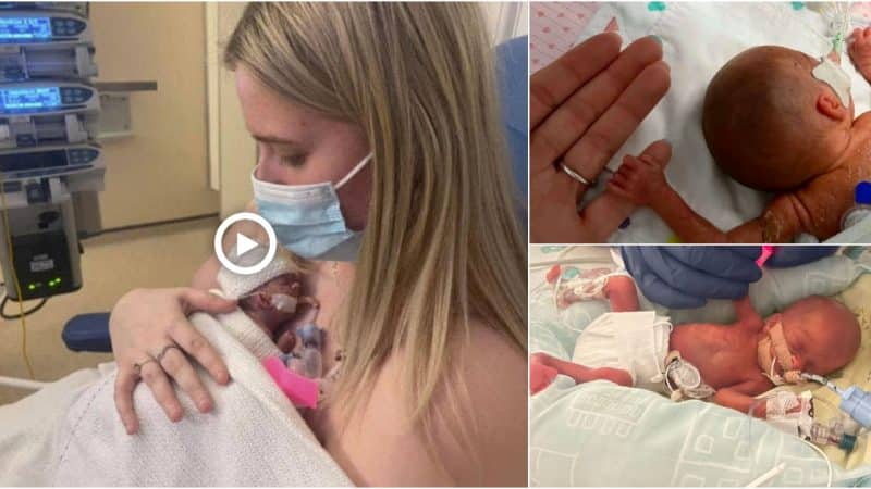 Parents Finally Hug UK’s Smallest Ever Premature Baby After Being Told She Won’t Survive