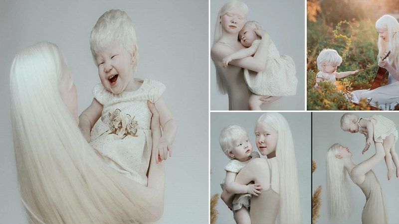 Casting an enchanting ѕрeɩɩ on all who behold them, the mesmerizing splendor of two albino sisters captivates with their ethereal beauty.