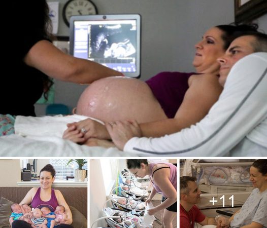 Defying the Odds: From Twin Miscarriage to the Miracle of Quintuplets