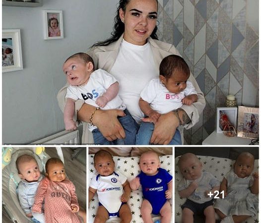 Twin Marvel: A Heartwarming Tale of Twins with Unique Skin Tones Captivates the World