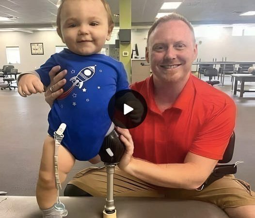 A Father’s DIY Miracle: Crafting Homemade Prosthetic Legs for His Baby’s First Steps