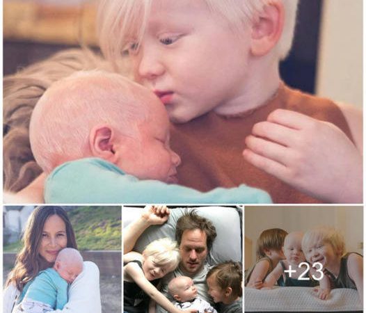 The Baby’s Remarkable White Hair Sparks Curiosity and Excitement