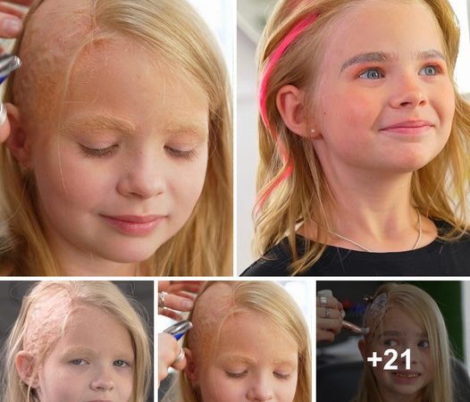 A Touching Transformation: Stylist Empowers Girl with Burn Scars, Bringing Heartwarming Smiles